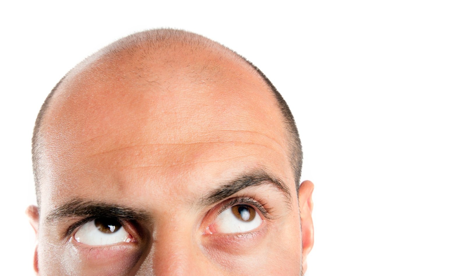 Top Major Causes Of Hair Loss In Men